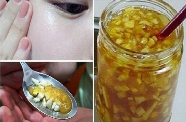 Tỏi ngâm mật ong